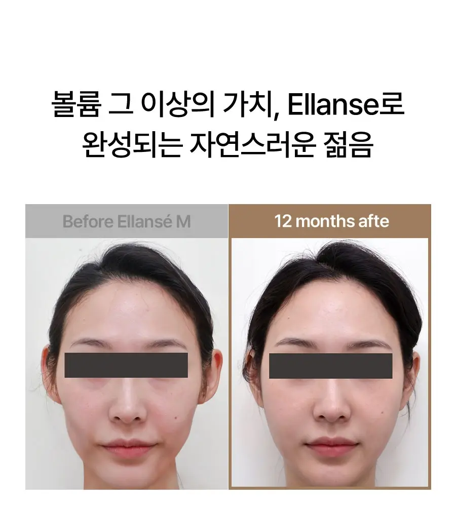 https://cdn.cashreview.kr/production/campaign/detail-content/5a20de8a-25b7-4c88-815a-fb4d17f0aa88.png