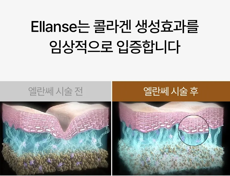 https://cdn.cashreview.kr/production/campaign/detail-content/72a75458-baf1-443f-8b1f-aa1be562beec.png