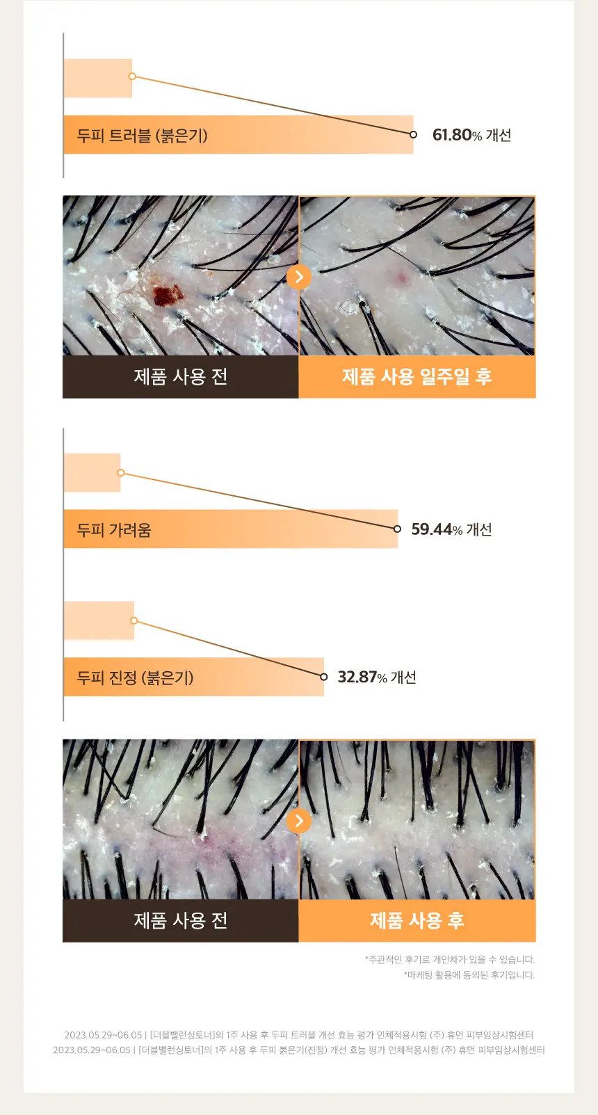 https://cdn.cashreview.kr/production/campaign/detail-content/9f614b39-4cae-44be-bf0b-fe45d2334e11.png