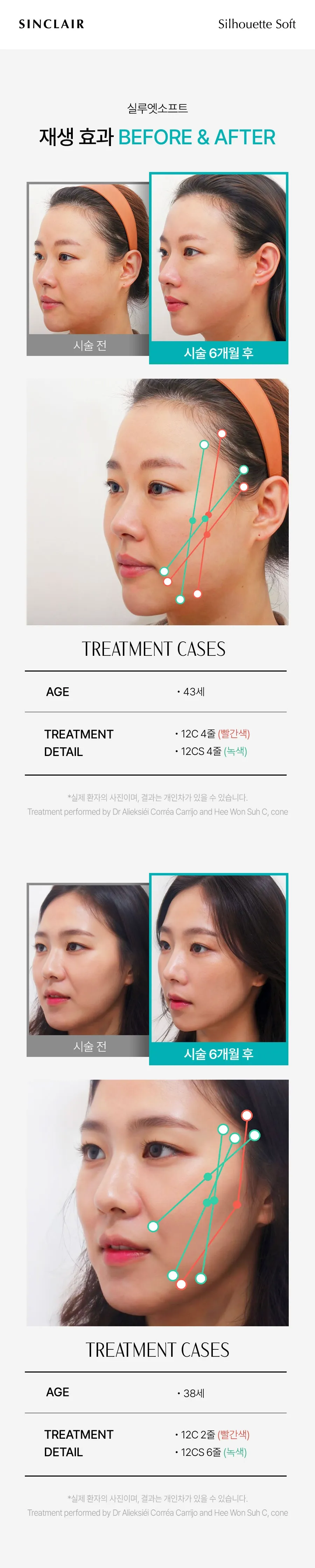 https://cdn.cashreview.kr/production/campaign/detail-content/a574216b-5e5f-4050-b035-8324c90a16f6.png