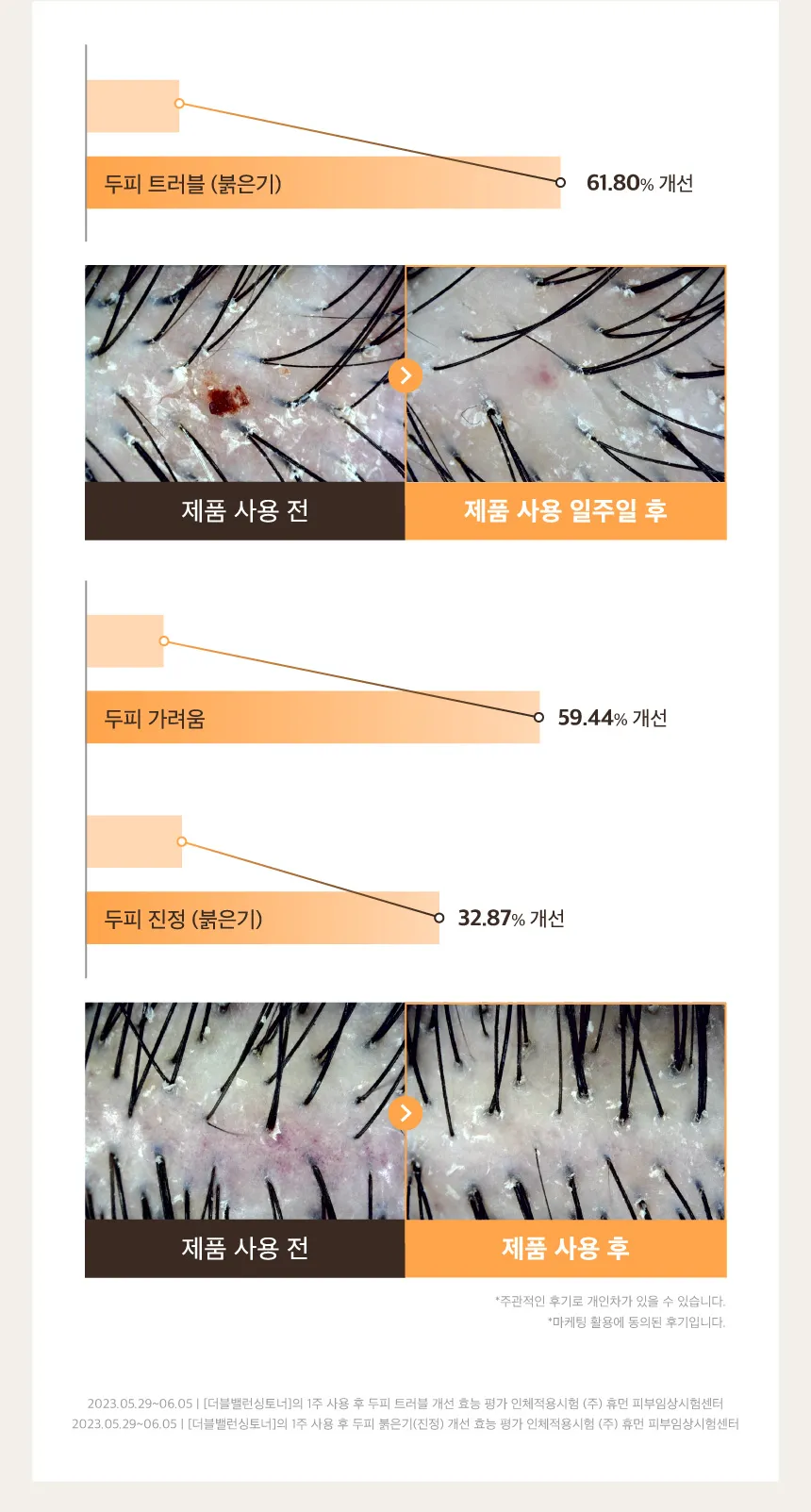 https://cdn.cashreview.kr/production/campaign/detail-content/ca0f5050-a743-4840-a197-c747303f7902.png