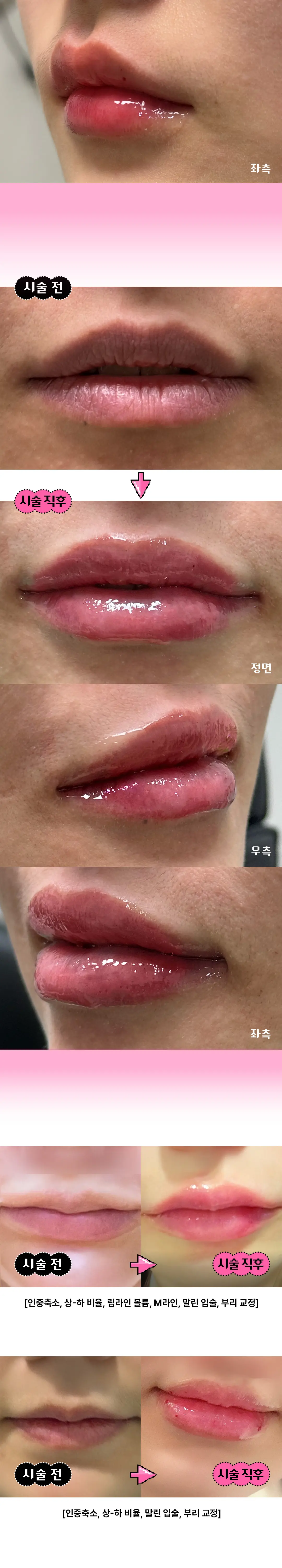 https://cdn.cashreview.kr/production/campaign/detail-content/e8394160-6076-42c8-b6c1-1bd7d8269226.png